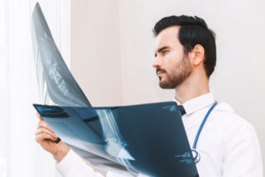 Doctor looking at x-ray photo in hospital.healthcare and medicine